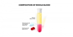 Heparin induced thrombocytopenia (HIT)