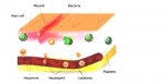 Disseminated Intravascular Coagulation (DIC) 