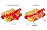 Physiopatology of haemostasis