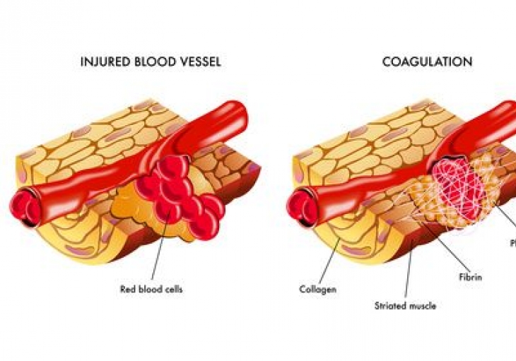 Physiopatology of haemostasis