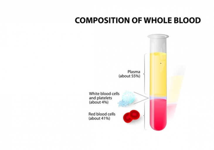 Heparin induced thrombocytopenia (HIT)