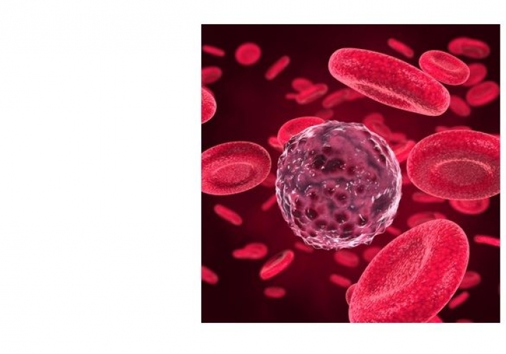 Thrombotic Thrombocytopenic Purpura (TTP)-Hemolytic Uremic Syndrome (HUS)   