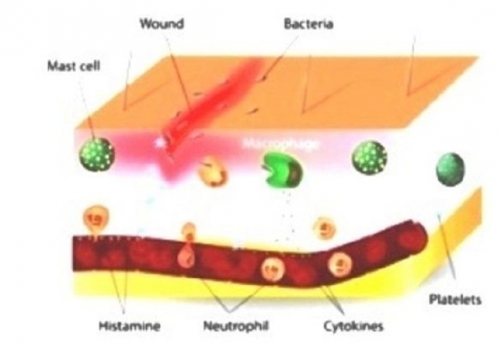 Disseminated Intravascular Coagulation (DIC) 